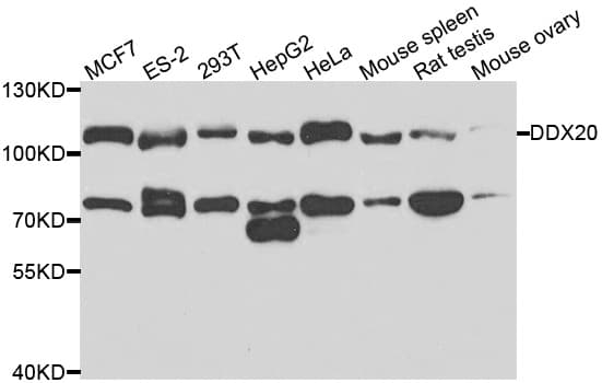 DDX20 / GEMIN3 Antibody