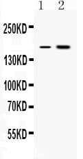 ERCC6 / CSB Antibody