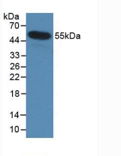 IL35 Antibody