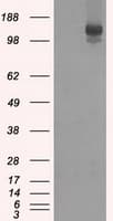 L1CAM Antibody (clone OTI2A6, Carrier-free)