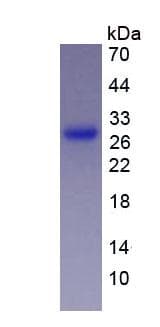 Human GZMA / Granzyme A Protein (Recombinant His, N-Terminal)