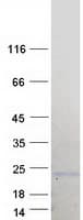 Human BCL7B Protein (Recombinant Myc-DDK (Flag))