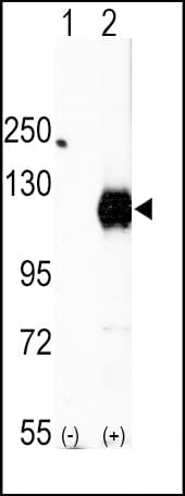 EPHA2 / EPH Receptor A2 Antibody (aa919-950)