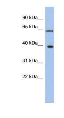 Polyclonal Rabbit anti-Human DDX3 / DDX3X Antibody (N-Terminus, WB)