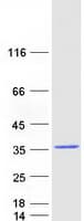 Human RAB9B Protein (Recombinant Myc-DDK (Flag))