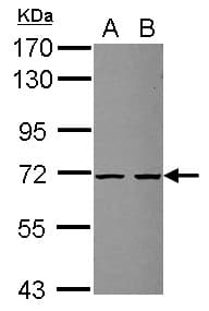 ZSWIM2 Antibody