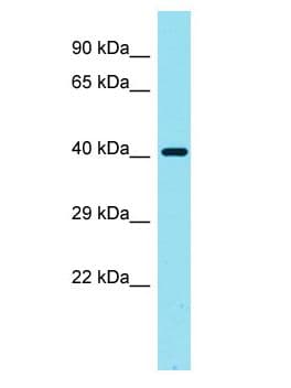 LGALS9C Antibody (aa272-321)