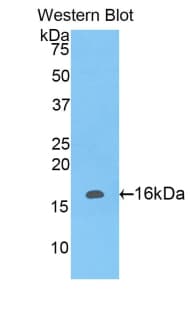 LAIR2 / CD306 Antibody (aa21-152, PE)
