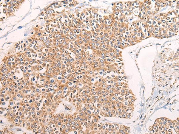 C14orf2 Antibody