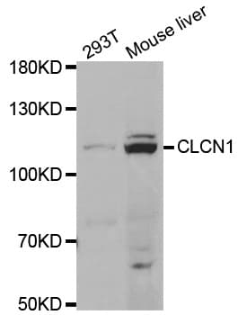 CLCN1 / CLC-1 Antibody