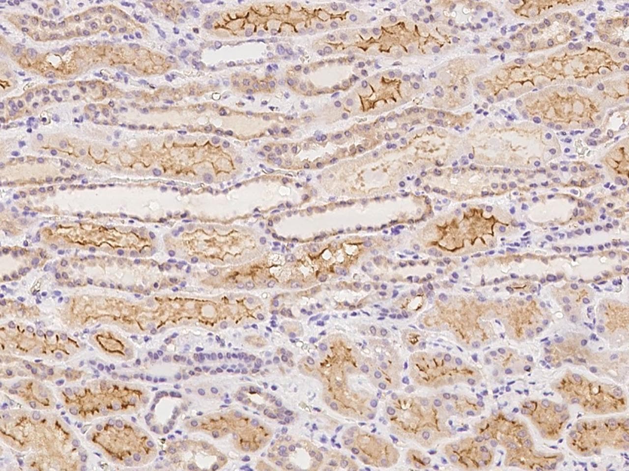 SNPH Antibody