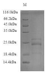 Mouse IL23A / IL-23 p19 Protein (Recombinant 6His, N-terminus)