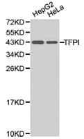 Polyclonal Rabbit anti-Human TFPI / LACI Antibody (IHC, WB)