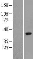 ASCC1 Protein (Over-Expression Lysate Myc-DDK (Flag))