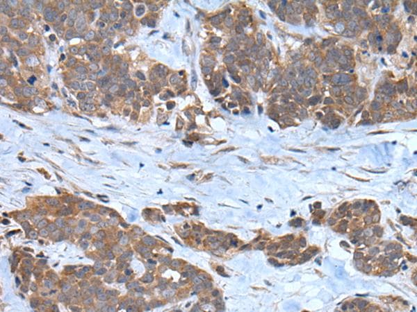Polyclonal Rabbit anti-Human CNTN1 / gp135 / Contactin 1 Antibody (IHC, WB)