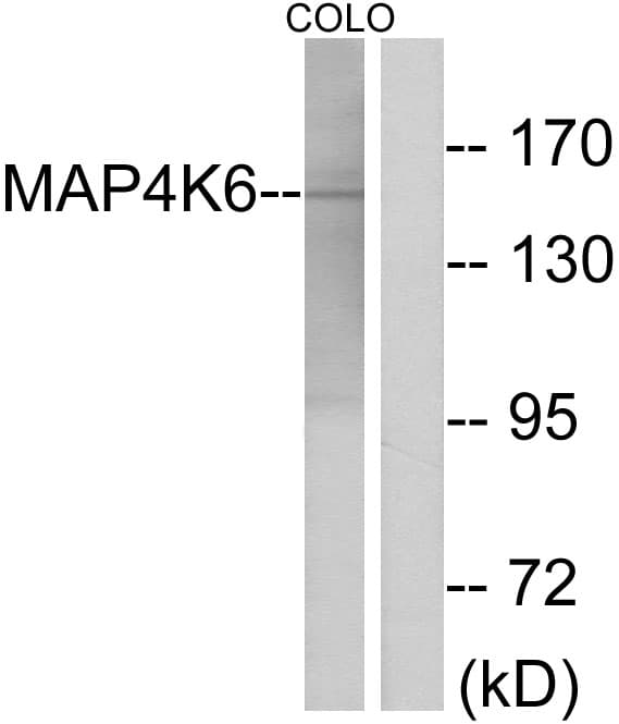MINK1 / MINK Antibody (aa401-450)