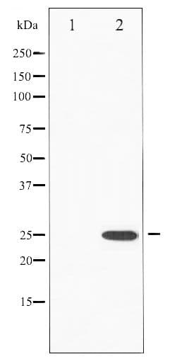 Polyclonal Rabbit anti-Human RHOA Antibody (phospho-Ser188, WB)
