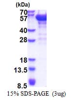 Human Dynactin 2 / Dynamitin Protein (Recombinant His)