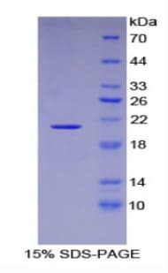 Mouse ACO1 / Aconitase Protein (Recombinant His)