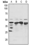 Polyclonal Rabbit anti-Human SRF / Serum Response Factor Antibody (IHC, WB)