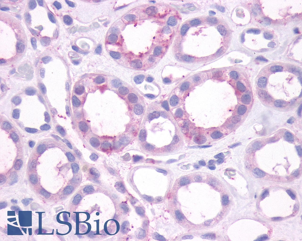 PathPlus™ DRD1 / Dopamine Receptor D1 Antibody (C-Terminus)