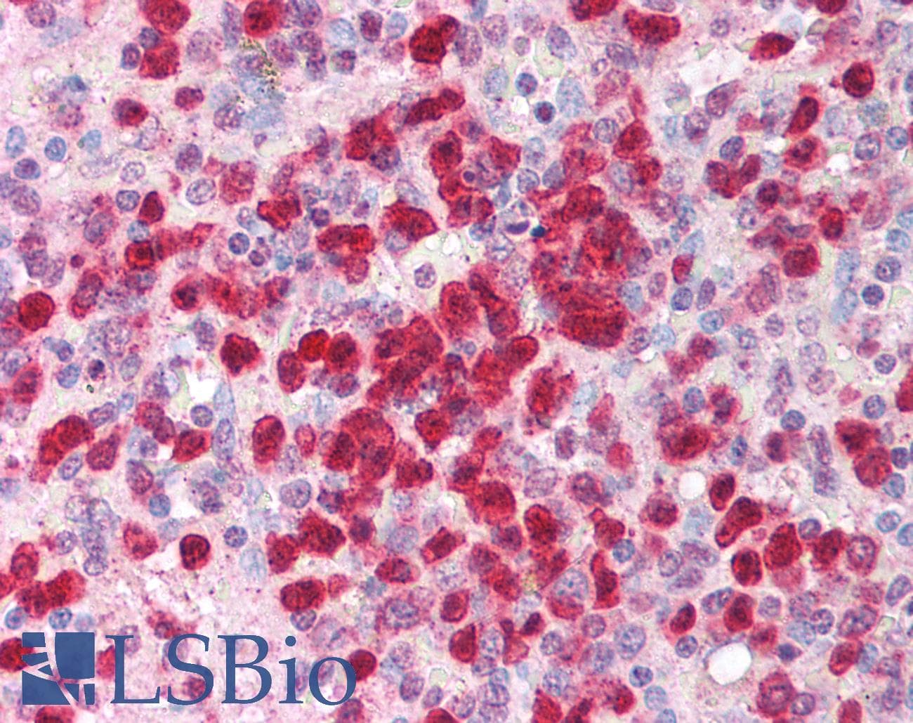 IHC-plus™ Polyclonal Rabbit anti-Human IL21 Antibody (IHC, WB)