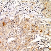 MTERF2 / MTERFD3 Antibody