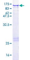 Human STAT1 Protein (Recombinant GST)