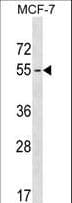 MAGEB18 Antibody (aa214-242)
