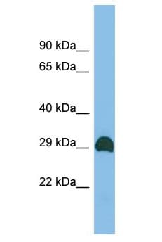 CWH43 Antibody (aa188-237)