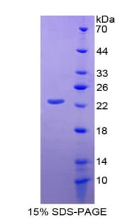 Human CD276 / B7-H3 Protein (Recombinant His-T7)