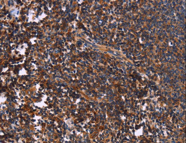 Polyclonal Rabbit anti-Human SYT4 Antibody (IHC)