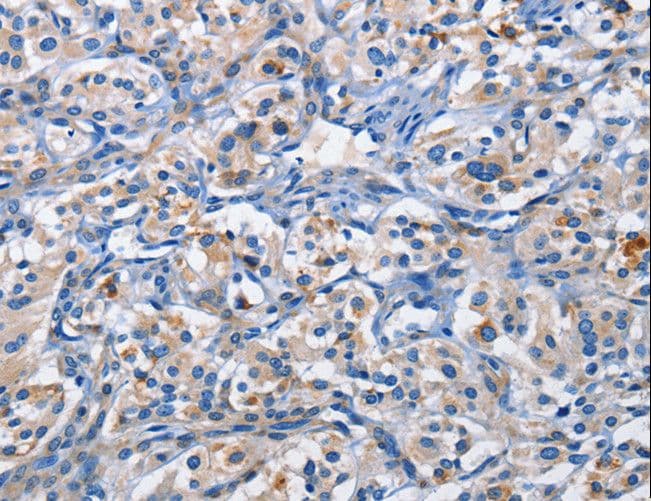 Polyclonal Rabbit anti-Human PIM1 / Pim-1 Antibody (IHC)