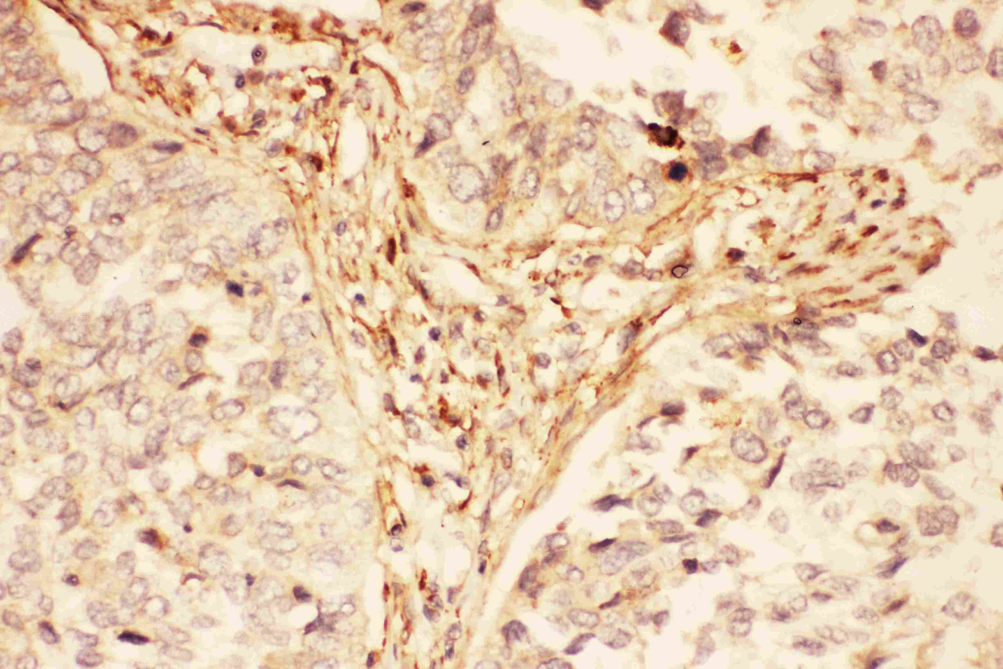 LIF Antibody (aa23-202)