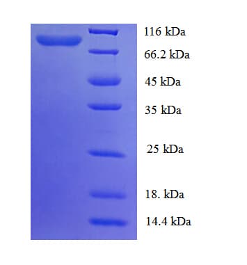 Human CYPOR / POR Protein (Recombinant GST)