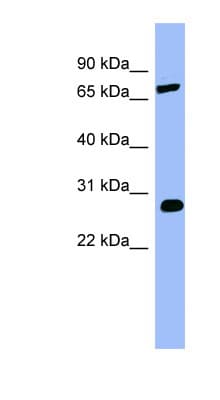 COMT Antibody (aa143-192)