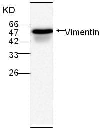 Monoclonal Mouse anti-Human Vimentin Antibody (WB)