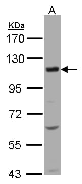 Polyclonal Rabbit anti-Human SLC12A7 / KCC4 Antibody (aa845-1083, WB)