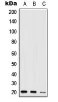 Polyclonal Rabbit anti-Human NIP7 Antibody (C-Terminus, WB)