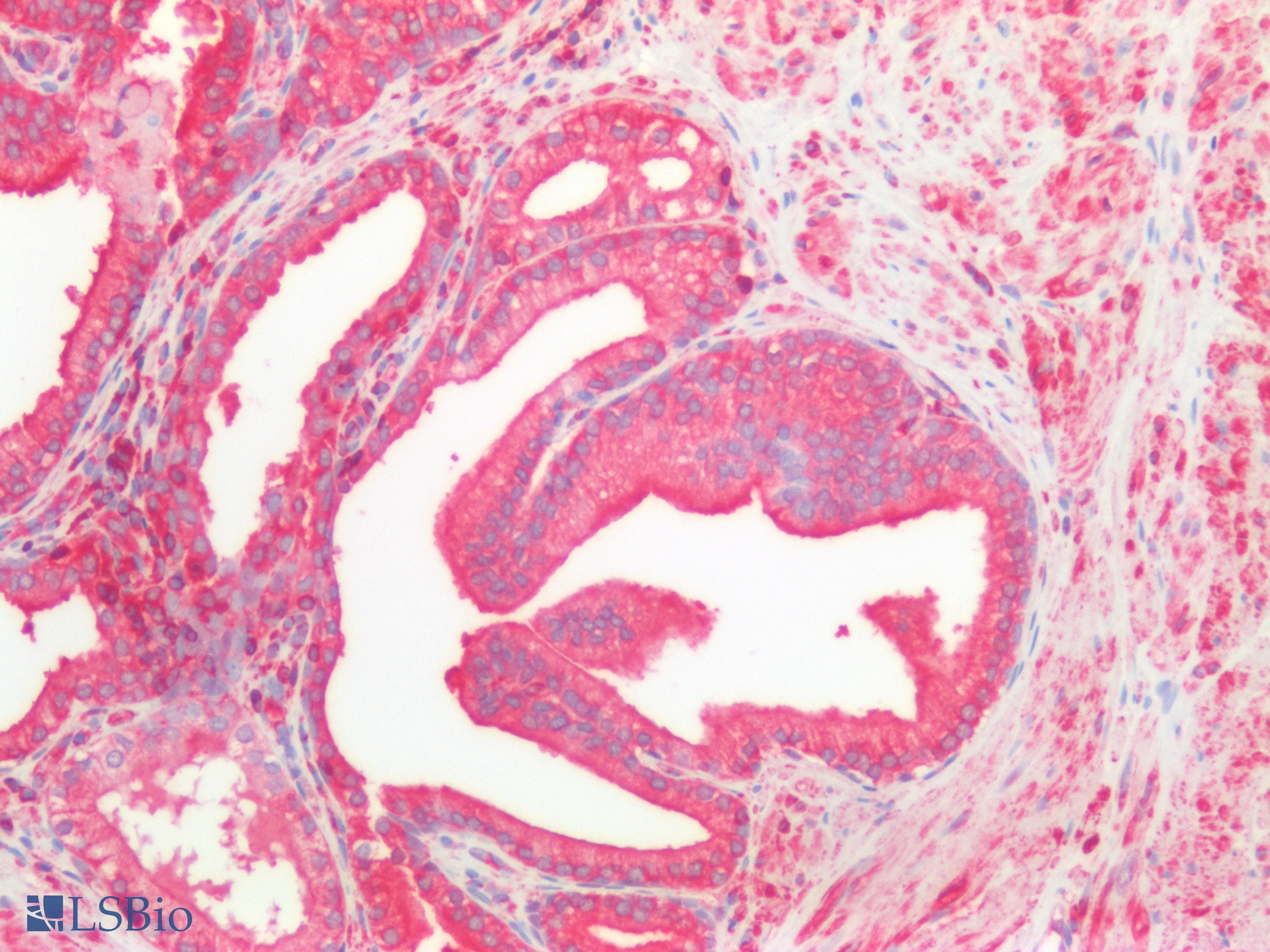 PathPlus™ Polyclonal Rabbit anti-Human CFL2 / Cofilin 2 Antibody (IHC, IF, WB)