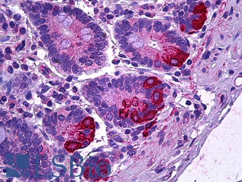 IHC-plus™ IL12A / p35 Antibody