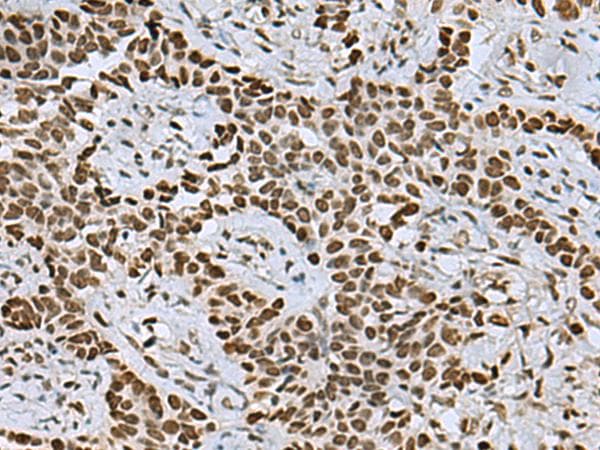 MYEF2 Antibody