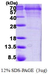Human CAMK4 / CaMK IV Protein (Recombinant His)