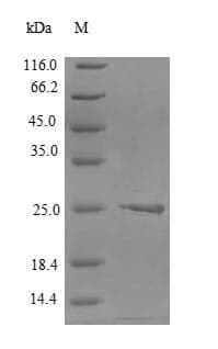 Human CLDN6 / Claudin 6 Protein (Recombinant 6His-SUMO, N-terminus)