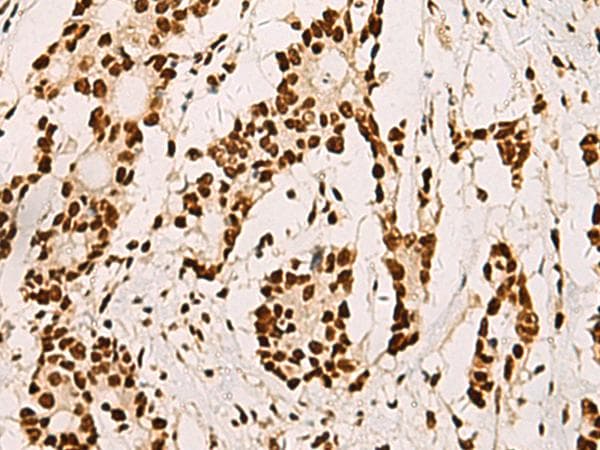 ELF5 Antibody