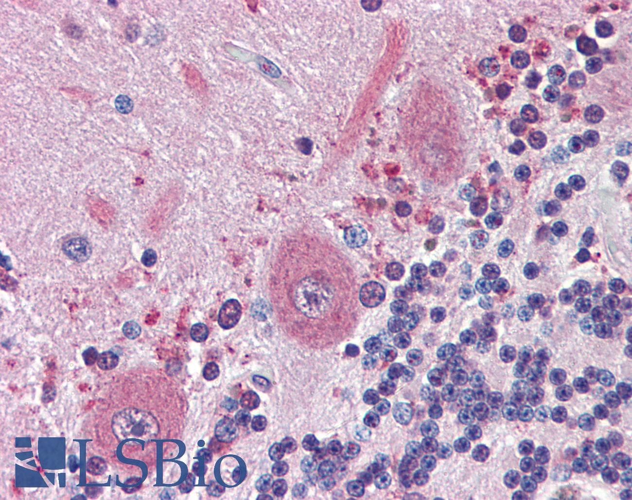 PathPlus™ BRAF / B-Raf Antibody (clone 1H12)