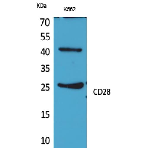 CD28 Antibody (11-60 aa, Internal)