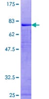 Human PICK1 Protein (Recombinant GST)