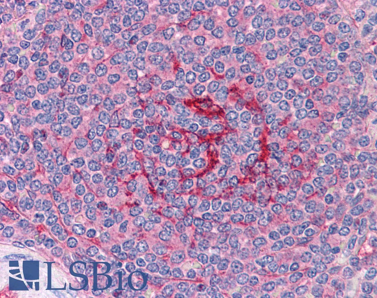 IHC-plus™ Polyclonal Goat anti-Human GABPB1 Antibody (aa198-210, IHC, IF, WB)
