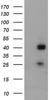 Alpha4GnT / A4GNT Antibody (aa121-340, clone OTI2H9)